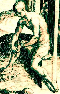 Removing Guinea Worms